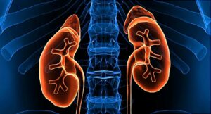 Read more about the article AHUS patients without kidney involvement- who are they