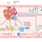 Micro clots in Long aHUS and COVID