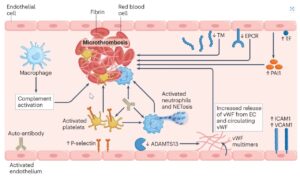 Read more about the article Micro clots in Long aHUS and COVID